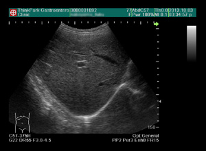 �����G�R�[�A�O���B�G�R�[